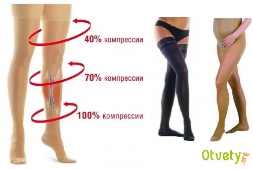 Как выбрать компрессионный трикотаж правильно